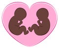 Black Twins Babies Pink Heart Birth Pregnancy Royalty Free Stock Photo