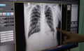 Black and white body , rib ,lung , heart , film X-ray