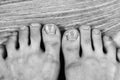 Black and white photo broken and ingrown ugly toenails of a sloppy girl Royalty Free Stock Photo