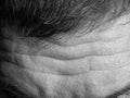Black and white photo of a male forehead with wrinkles and porous skin Royalty Free Stock Photo