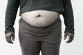 Black and white picture style for Close-up of fat woman on white background. Concept for obesity issue, diet of food for health Royalty Free Stock Photo