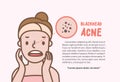 Blackhead acne woman cartoon action half body layout banner illustration vector on pink background. Beauty concept Royalty Free Stock Photo