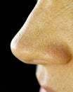 Blackheads On Nose. Macro Royalty Free Stock Photo