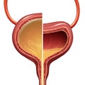 Bladder Normal And Overactive Condition