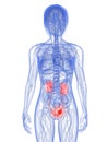 Bladder cancer