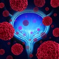 Bladder Cancer Royalty Free Stock Photo