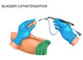 Bladder catheterization for men