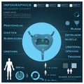 Bladder Infographic Infocharts Health And Medical