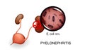 Bladder and kidneys. pyelonephritis