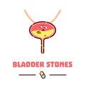 Bladder stones cartoon poster