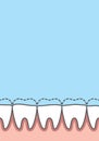Blank banner attrition Bruxism teeth illustration vector on blue background. Dental concept