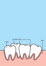 Blank banner Crowding tooth frame cartoon style for info or book illustration vector on blue background. Dental concept Royalty Free Stock Photo