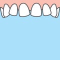 Blank banner Upper askew teeth illustration vector on blue background. Dental concept Royalty Free Stock Photo