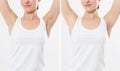 Blank template t shirt. Before after Beauty Woman perfect skin armpits epilation . Beforeafter Laser armpithair removal. Royalty Free Stock Photo