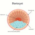 Blastocyst vector diagram Royalty Free Stock Photo