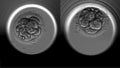 Blastocyst formation human egg fertility cell division.