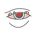blepharitis disease, redness of eyeball color icon vector illustration