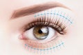 Blepharoplasty treatment, plastic surgery, face lift concept. Female eye close up Royalty Free Stock Photo