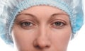 Blepharoplasty of the upper eyelid. Royalty Free Stock Photo