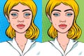 Blepharoplasty woman face before and after. Under eye lifting facial procedure side by side comparison, vector illustration in pop