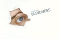 Blindness disease poster with blue eye on left. Royalty Free Stock Photo
