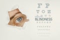 Blindness disease poster with eye test chart and blue eye on left Royalty Free Stock Photo