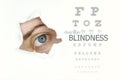 Blindness disease poster wwith eye test chart and blue eye on left