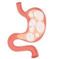 Bloating. Heaviness in stomach. Gases problem, gastritis and acid reflux, indigestion, vomiting, heartburn and stomach pain