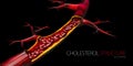 Blocked blood vessel - artery with cholesterol buildup realistic 3d illustration isolated background