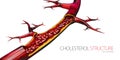 Blocked blood vessel - artery with cholesterol buildup realistic 3d illustration isolated white
