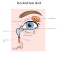 blocked tear duct diagram medical science