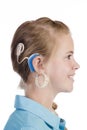 Blond girl with cochlear implant
