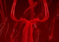 Blood arteries Royalty Free Stock Photo