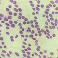 Blood cell in Giemsa stain