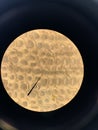 blood cells and expression of mitosis and meiosis of cells