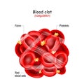 Blood clot structure. thrombus