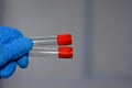 Blood collection tube for collecting blood samples for laboratory analysis tests like CBC complete blood count, ESR, CRP, FBS,