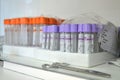 Blood collection tubes with orange and purple lids are in cabinet with medical scissors Royalty Free Stock Photo