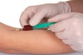 Blood Extraction