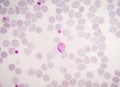 Blood films for Malaria parasite. Royalty Free Stock Photo