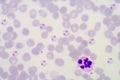 Blood films for Malaria parasite Royalty Free Stock Photo
