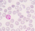 Blood films for Malaria parasite Royalty Free Stock Photo