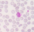 Blood films for Malaria parasite Royalty Free Stock Photo