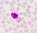 Blood films for Malaria parasite Royalty Free Stock Photo