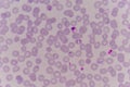 Blood films for Malaria parasite. Royalty Free Stock Photo