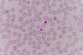 Blood films for Malaria parasite. Royalty Free Stock Photo