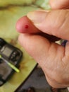 blood on finger for measures the amount of sugar or glucose. Your doctor may order this test to help diagnose diabetes.