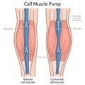 Calf Muscle Pump Mechanism diagram medical science Royalty Free Stock Photo