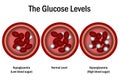 Blood Glucose Levels. normal level, hyperglycemia and hypoglycemia