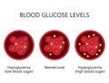 Blood Glucose Sugar Levels.